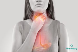 Gastroesophageal Reflux Disease Signs and Symptoms