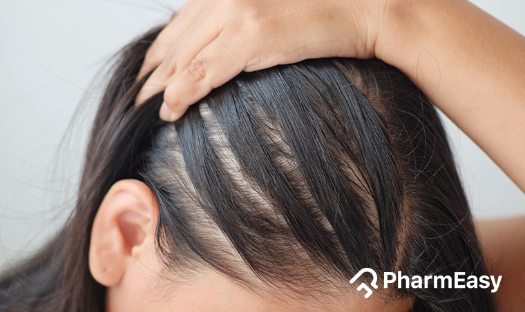 Home Remedies For Hair Thinning - PharmEasy Blog