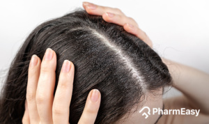 Natural Home Remedies For Hair Fall - PharmEasy Blog