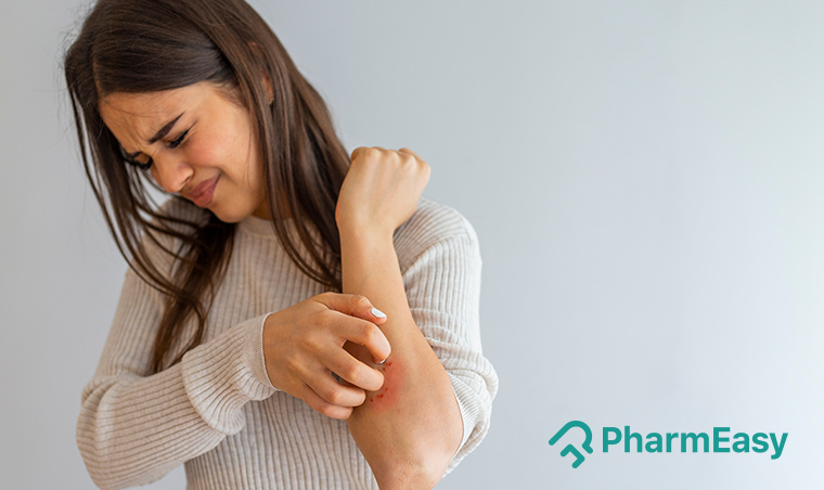 Natural Home Remedies for Itchy Skin - PharmEasy Blog