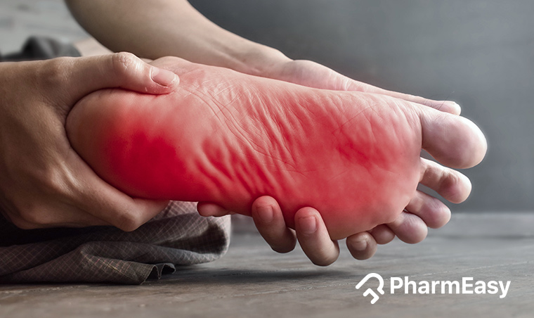 Best Home Remedies for Burning Feet - PharmEasy Blog