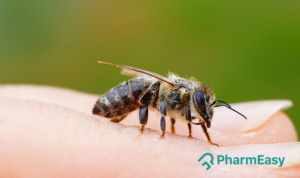 home remedies for bee sting