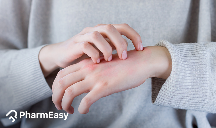 Effective Home Remedies for Scabies - PharmEasy Blog