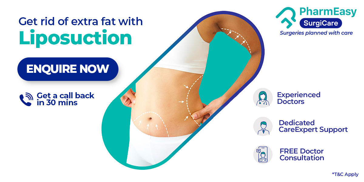 Why Is It Important To Exercise After Liposuction? PharmEasy Blog