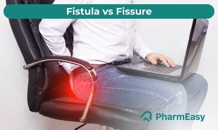 Difference Between Fissure and Fistula | Pharmeasy Surgicare