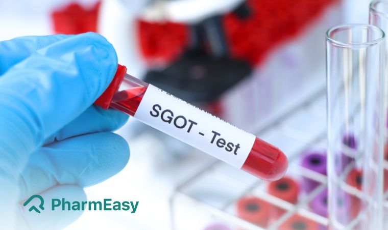  SGOT Test 