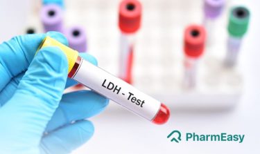 LDH Test