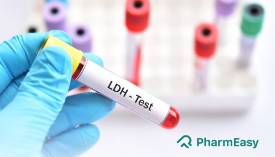 LDH Test