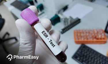 ईएसआर टेस्ट