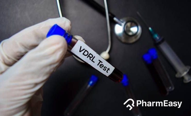 वीडीआरएल परीक्षण