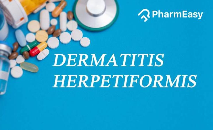 Dermatitis herpetiformis: Causes, treatment, and management - PharmEasy ...