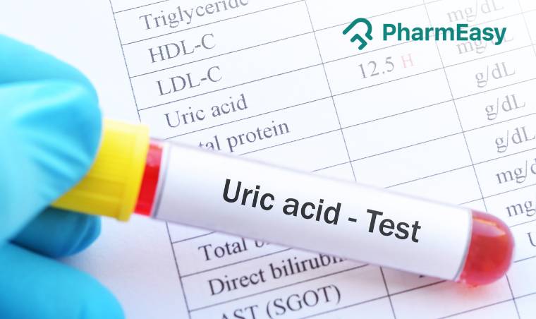 Important Things You Should Be Aware Of About Uric Acid Blood Test