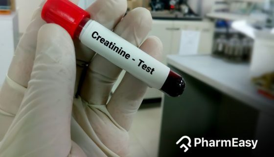 क्रिएटिनिन टेस्ट
