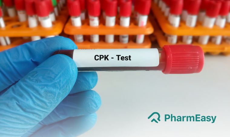 सीपीके परीक्षण (CPK Test): क्या है, खर्च, नॉर्मल रेंज, कैसे होता है, क्यों और कब