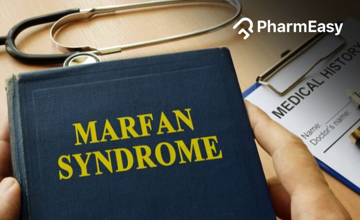 Finger length in Marfan syndrome - Mayo Clinic