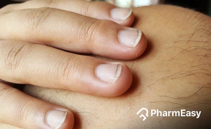 Predicting health conditions from the fingernails