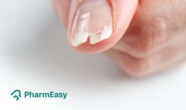 what causes fingernails to crack down the middle