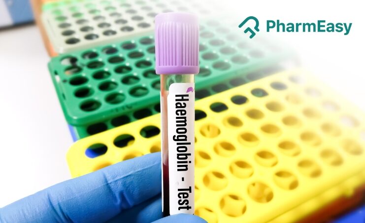 Haemoglobin Test Haematocrit Test And RBC Test Everything You Need To   Pharmeasy Blog 32 741x452 