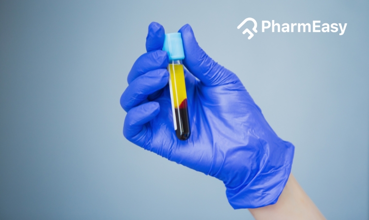 PDW Blood Test: Understanding Its Purpose and Results