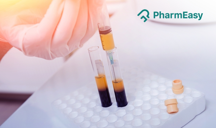 High PDW Blood Test: Understanding What it Means for Your Health