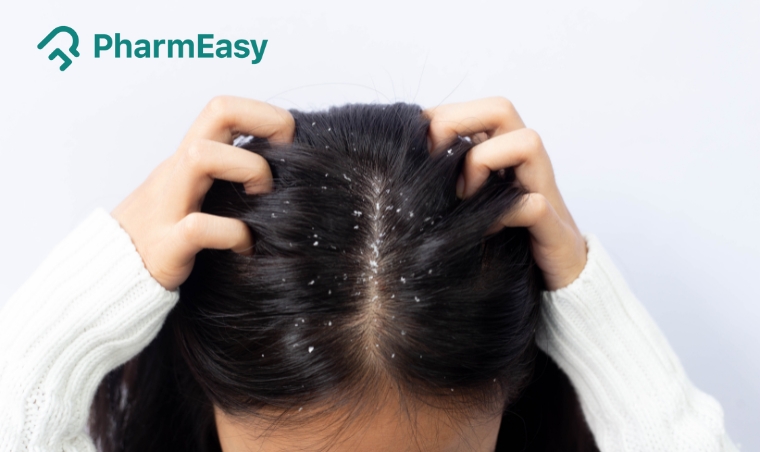 Dandruff Vs Dry Scalp: Recognizing the Difference and Treatment Options