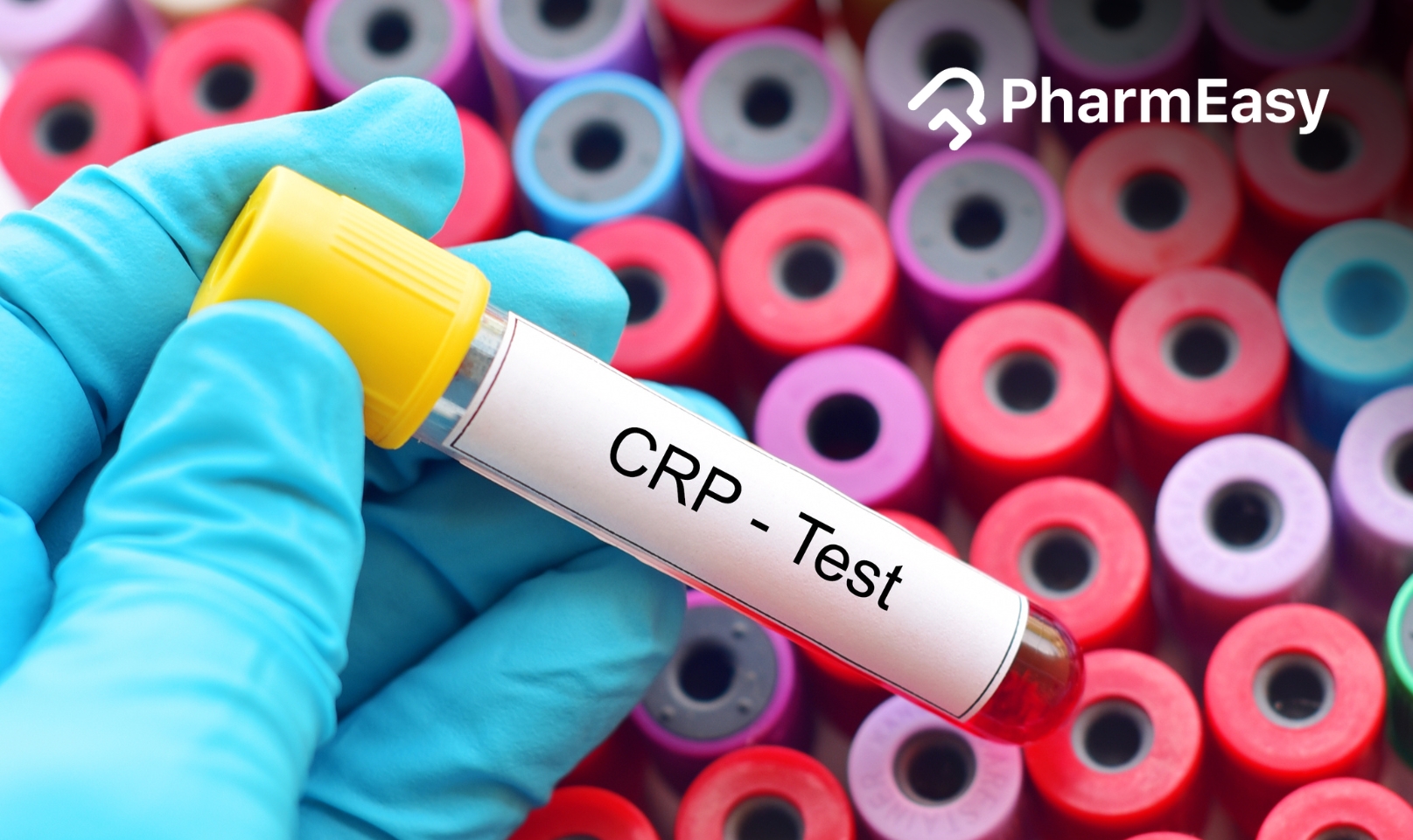 CRP Test Report: Interpreting Results and Their Medical Implication