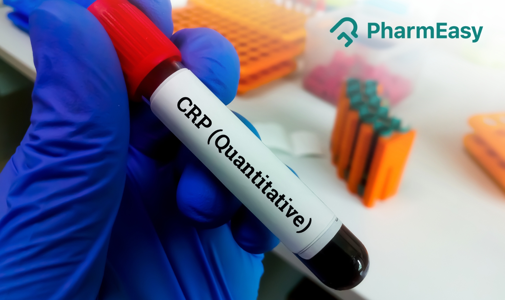 CRP Blood Test Cancer: Understanding its Significance in Diagnosis and Treatment