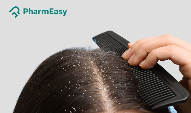 Does Dandruff Cause Hair Loss? Uncovering the Truth with Expert Insights