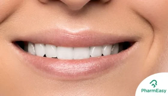 teeth whitening home remedies