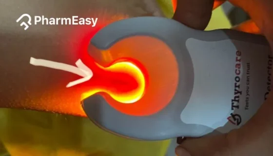 vein finder device