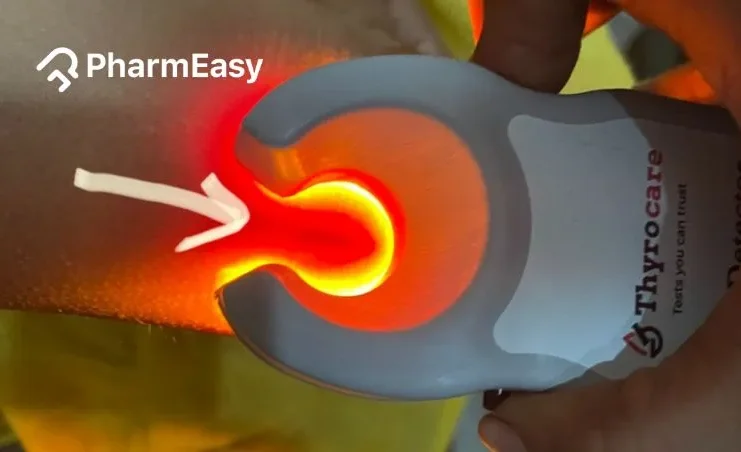 vein finder device