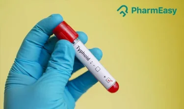 typhoid test