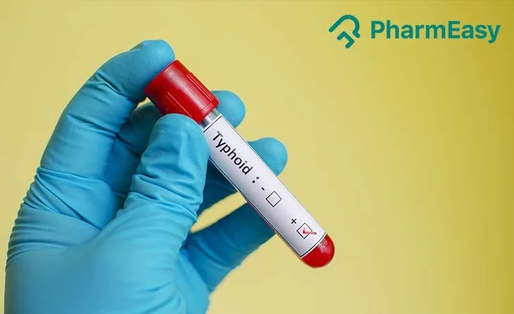 typhoid test