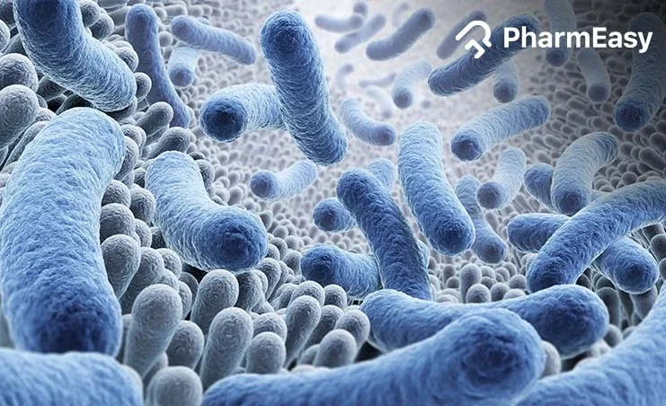 bacterial pneumonia