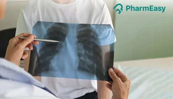 lobar pneumonia